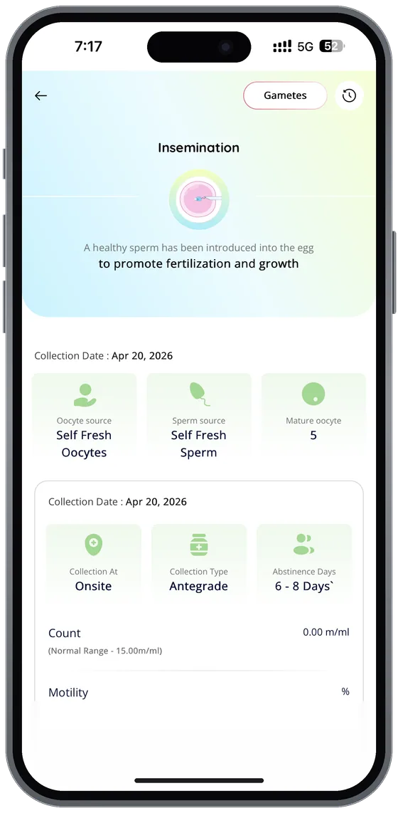 MedX appointment calendar showing upcoming monitoring scans and lab appointments organised by cycle day.