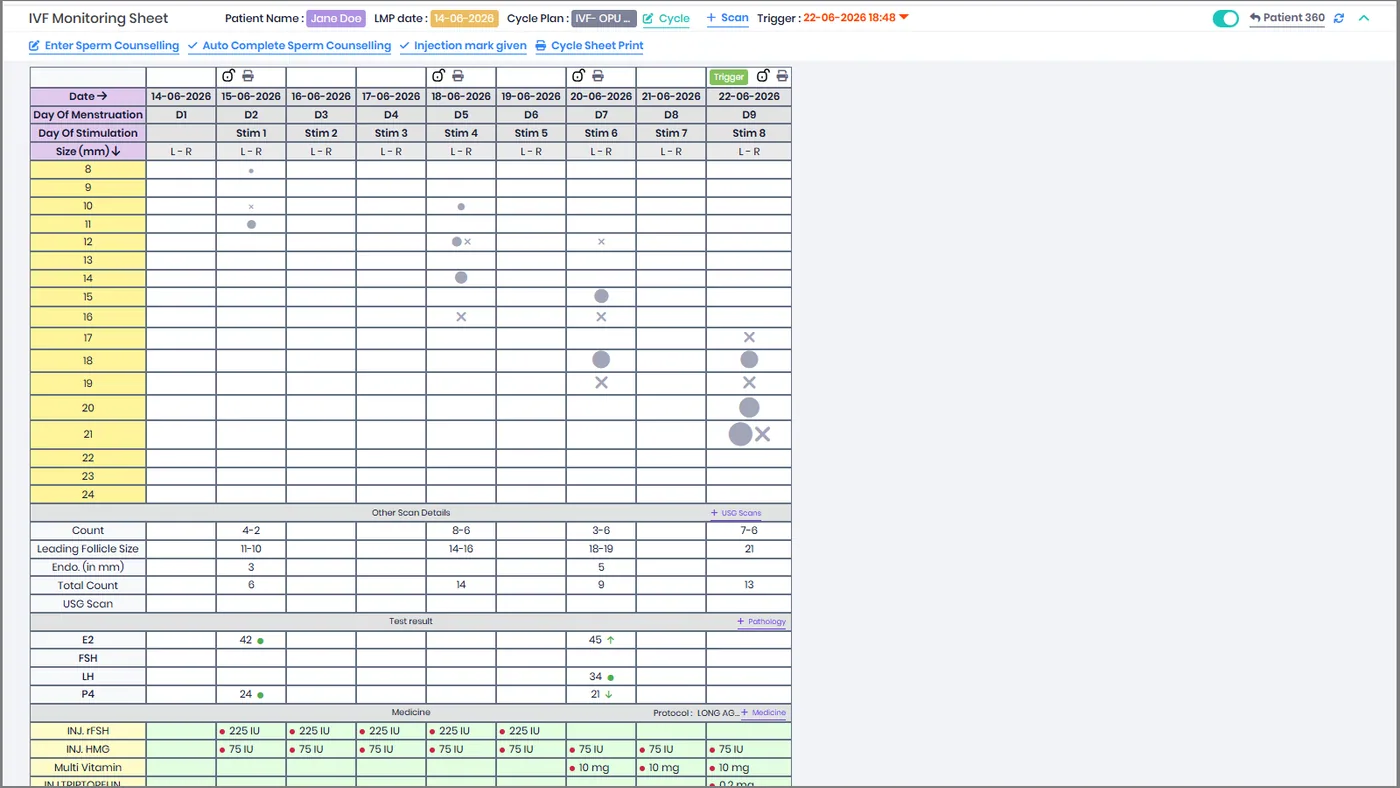 MedART cycle-planning dashboard — per-patient cycle timeline with stimulation, retrieval and transfer stages.